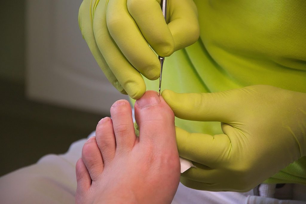 foot care, podiatry, treatment, feet, foot care, foot care, podiatry, podiatry, podiatry, podiatry, podiatry